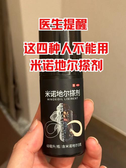 米诺地尔要一直用吗