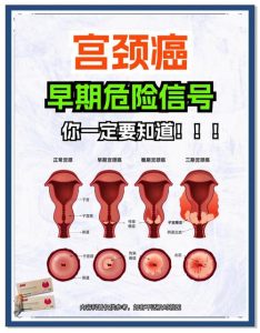 宫颈病变能保守观察吗？哪些情况可以先不手术？-两性知识丨两性健康--你想了解的我都知道