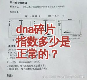 精子DNA碎片率多少算正常-两性知识丨两性健康--你想了解的我都知道