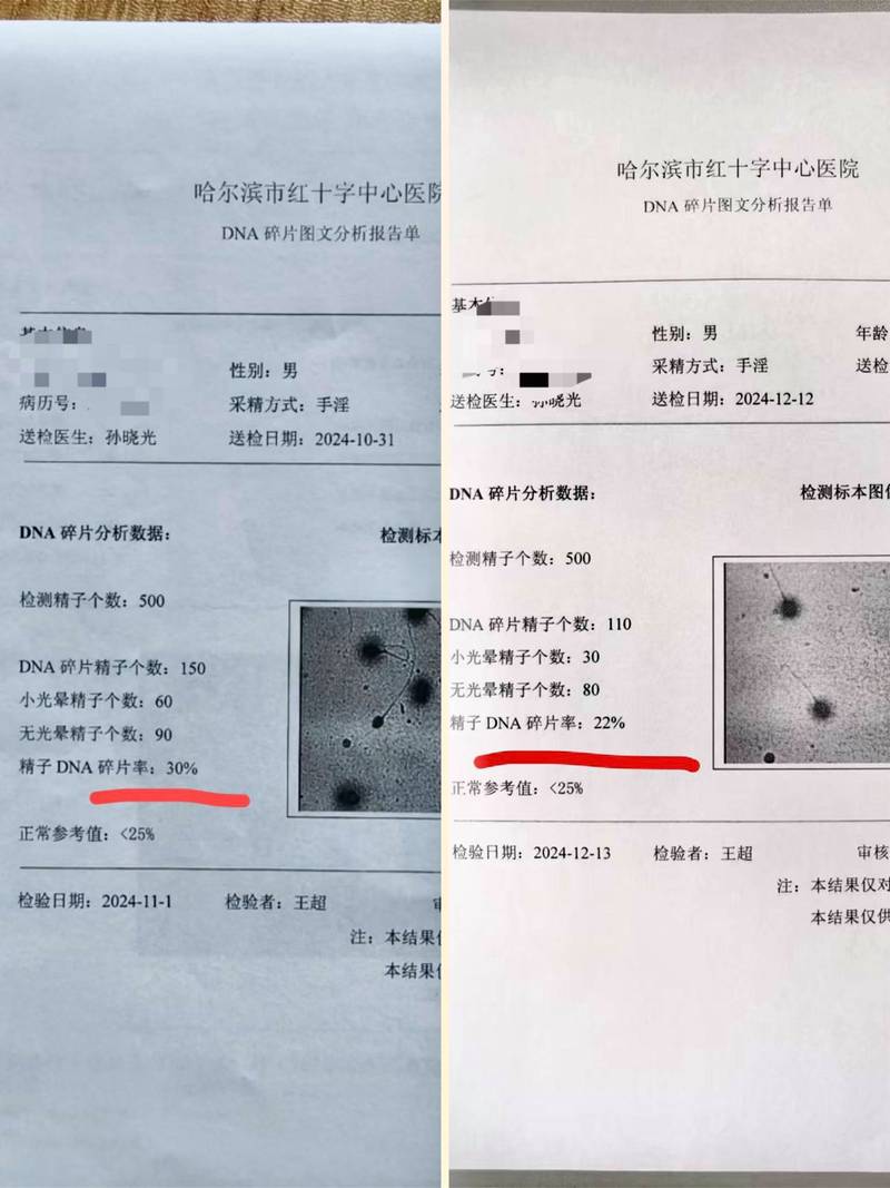 精子DNA碎片率多少算正常