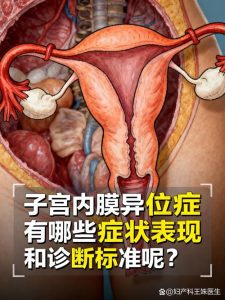 子宫内膜异位症会不会影响月经,发现了该怎么办?-两性知识丨两性健康--你想了解的我都知道
