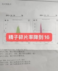 精子碎片率高还能自然怀孕吗？别慌，看完这篇心里就有底了-两性知识丨两性健康--你想了解的我都知道