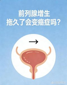 前列腺增生一直不治,真的会变成癌吗?-两性知识丨两性健康--你想了解的我都知道