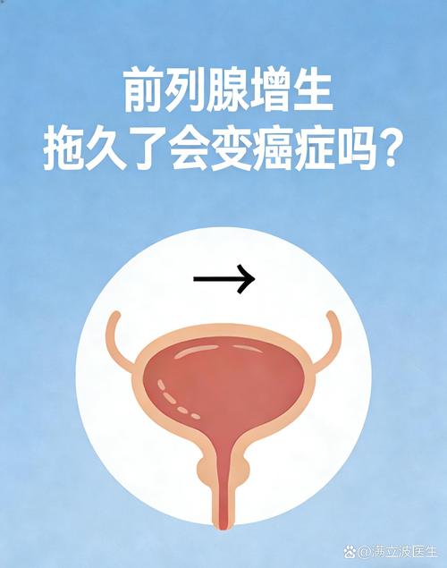 前列腺增生不治,会变癌吗