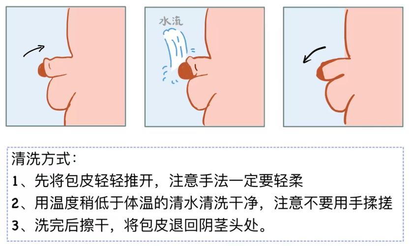 男性私处日常清洁,该怎么做