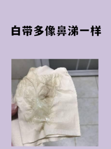 白带多是排毒的说法对吗-两性知识丨两性健康--你想了解的我都知道