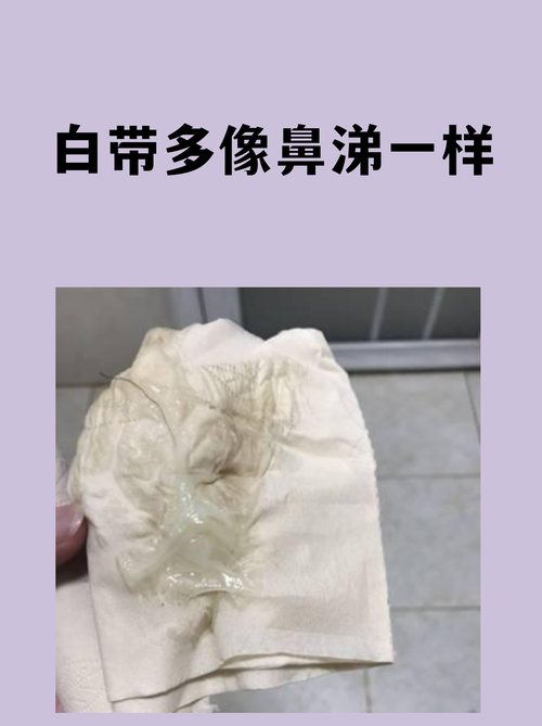 白带多是排毒的说法对吗