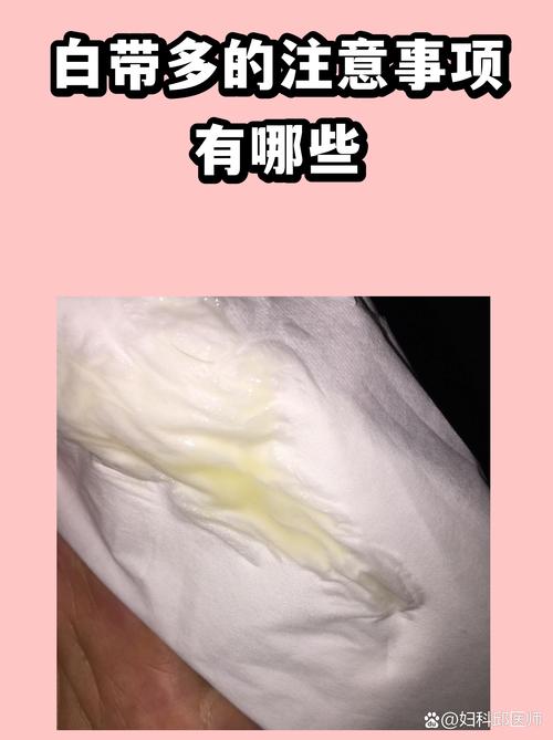 白带多是排毒的说法对吗
