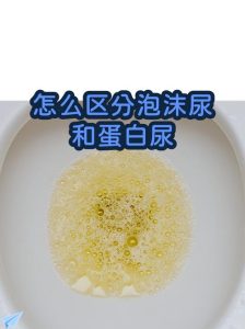 泡沫尿多是前列腺有问题吗?需要做什么检查-两性知识丨两性健康--你想了解的我都知道