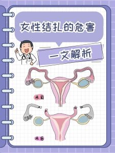 女性结扎后,性欲真的会下降吗?-两性知识丨两性健康--你想了解的我都知道