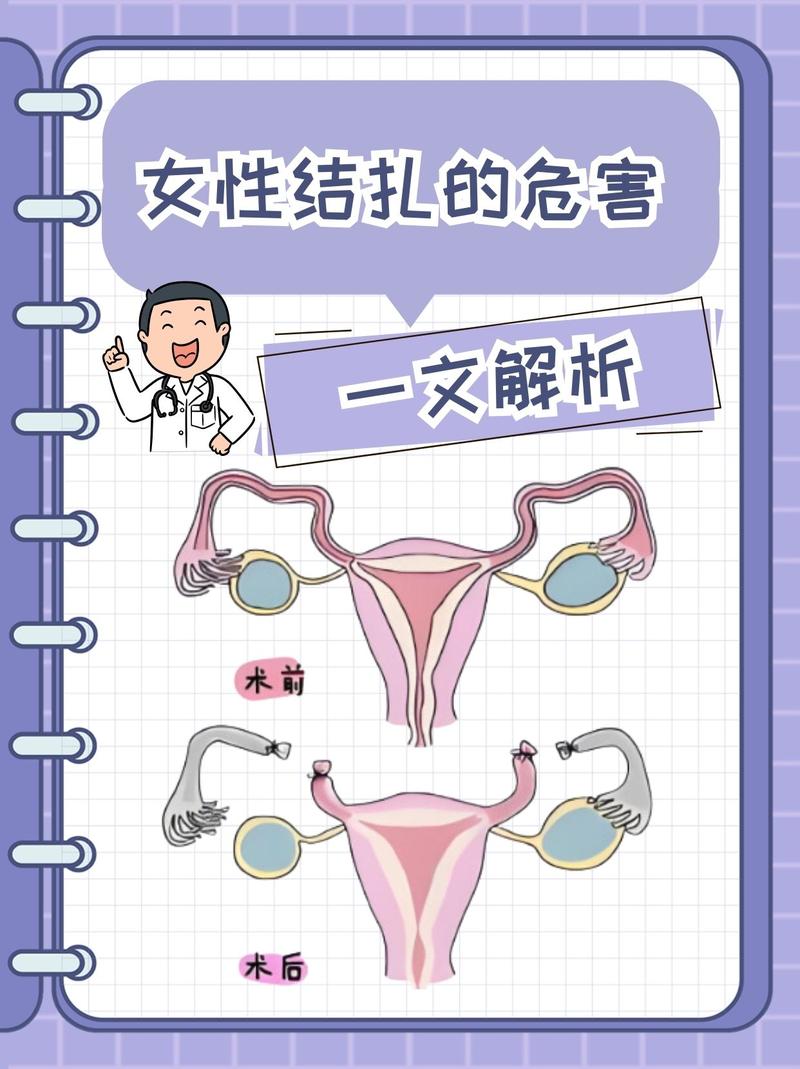 女性结扎会影响性欲吗