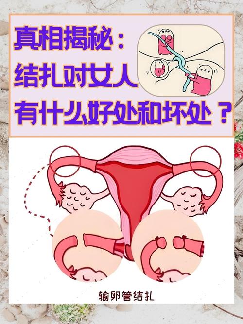 女性结扎会影响性欲吗