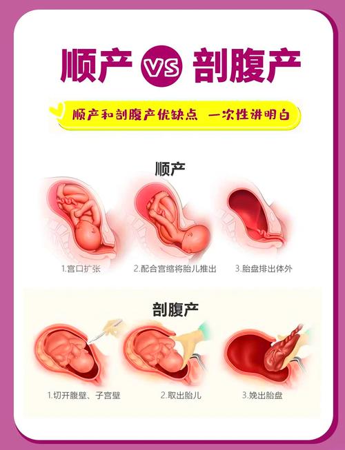 顺产和剖腹产都会伤盆底吗