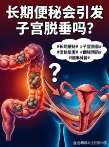 长期便秘会加重子宫脱垂吗?一文讲清两者的真实关系-两性知识丨两性健康--你想了解的我都知道