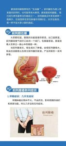 前列腺炎会变成前列腺癌吗-两性知识丨两性健康--你想了解的我都知道