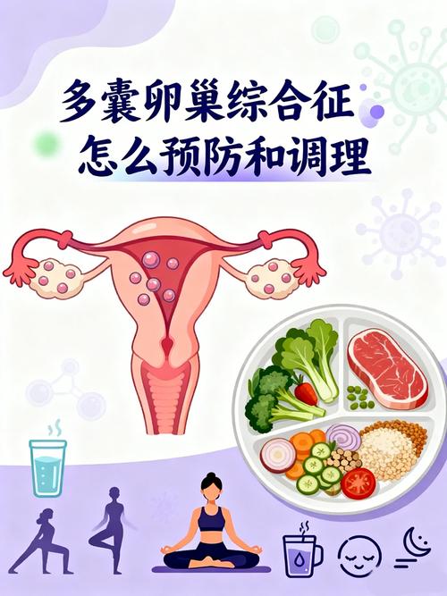 多囊卵巢综合征能预防吗