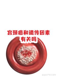 妇科癌症和遗传基因到底有没有关系?会不会传给下一代?-两性知识丨两性健康--你想了解的我都知道