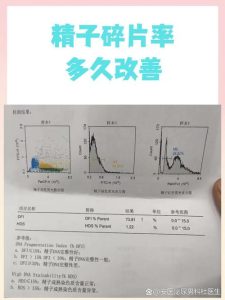 精子碎片率复查间隔多久合适?-两性知识丨两性健康--你想了解的我都知道