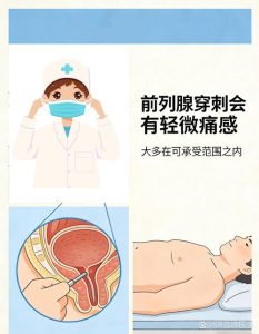 前列腺穿刺活检到底疼不疼?真实感受是这样的-两性知识丨两性健康--你想了解的我都知道