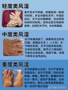 性欲低和类风湿关节炎有关吗-两性知识丨两性健康--你想了解的我都知道