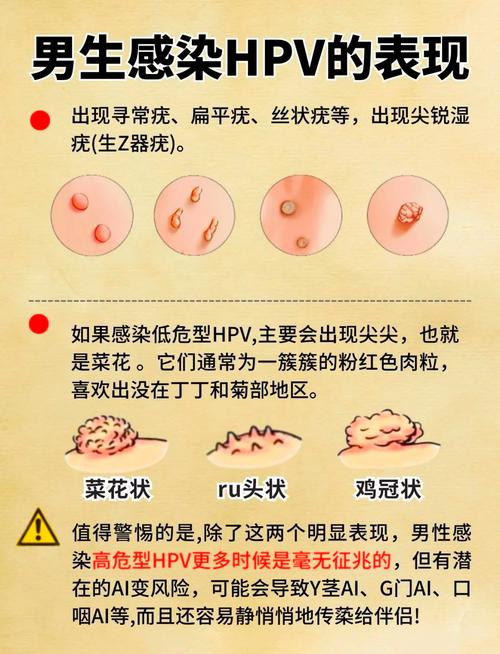 男性怎么知道,自己感染了HPV