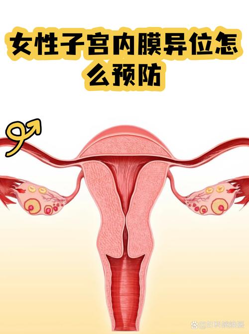 子宫内膜异位症会影响性欲吗