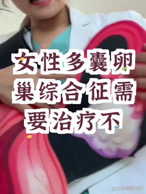 多囊需要长期随访吗