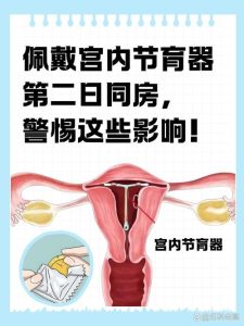 上环之后,欲望会跟着“掉线”吗?-两性知识丨两性健康--你想了解的我都知道