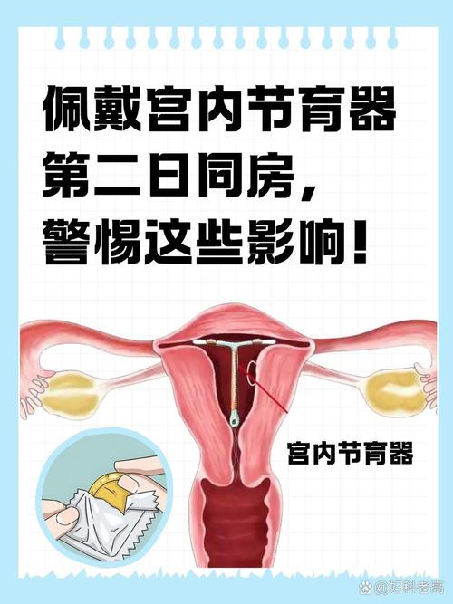 放置节育环会影响性欲吗