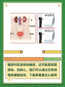 射精后小便刺痛,是尿道出问题了吗?-两性知识丨两性健康--你想了解的我都知道