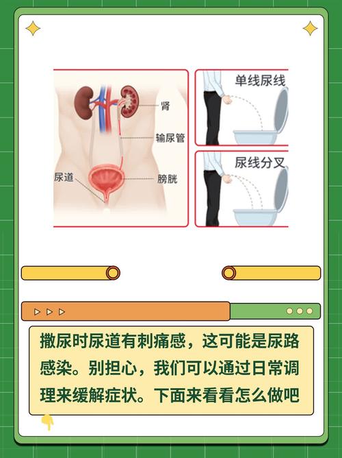 射精后小便刺痛,是尿道问题吗