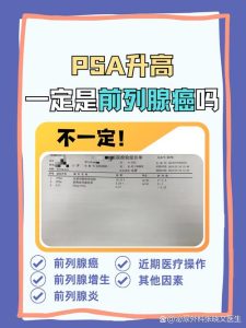 PSA升高就是前列腺癌吗?先别慌,答案在这里-两性知识丨两性健康--你想了解的我都知道