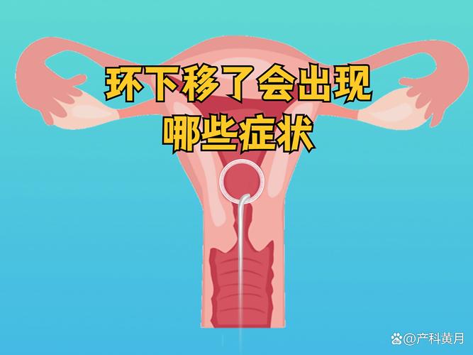 避孕环移位会有什么信号
