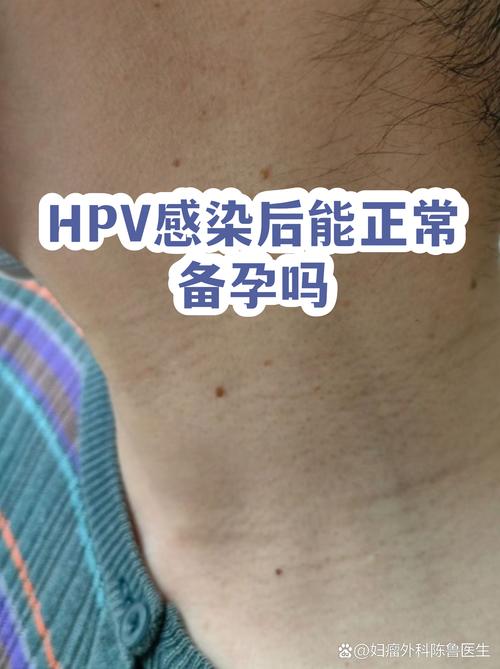 HPV阳性还能正常备孕吗