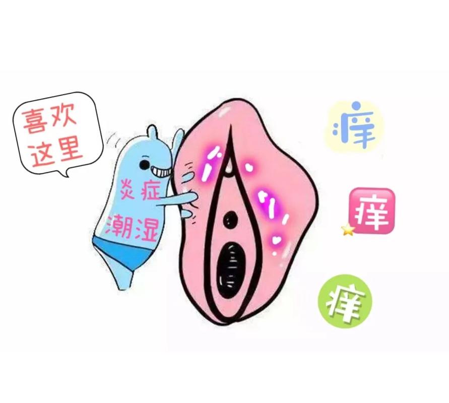 外阴瘙痒反复该从哪查起