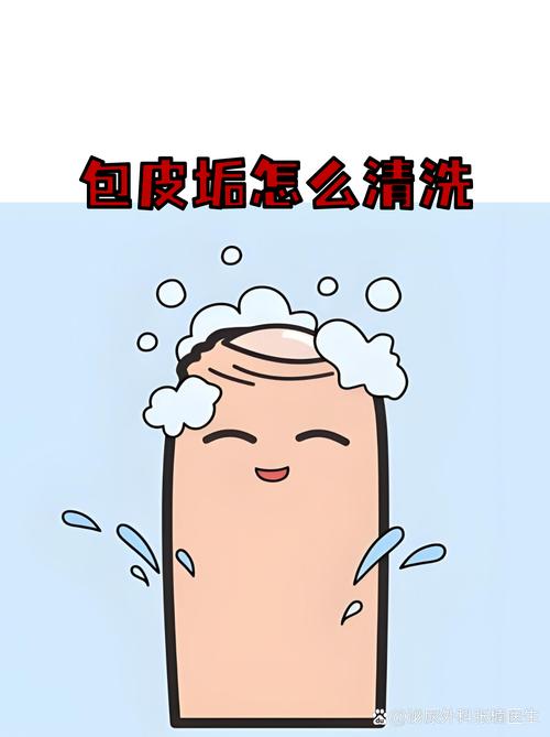 包皮垢增多该怎么清洁