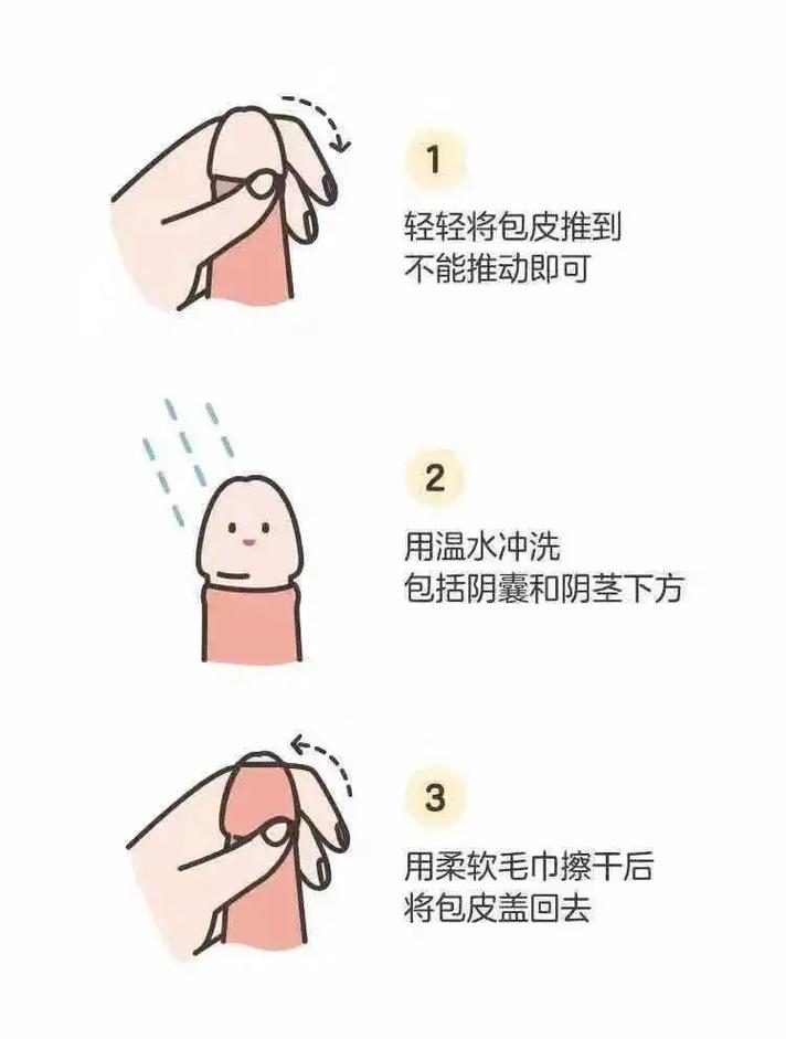 包皮垢增多该怎么清洁