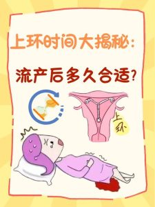 人流术后什么时候能恢复性生活-两性知识丨两性健康--你想了解的我都知道