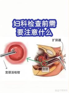 看妇科前需要提前做哪些准备?-两性知识丨两性健康--你想了解的我都知道