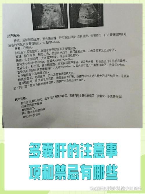多囊患者需要查肝功能吗