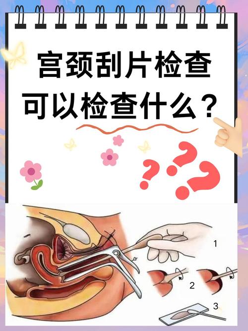 宫颈管搔刮有必要做吗