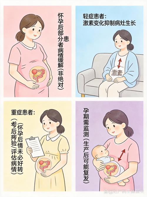 内异症患者怀孕能缓解病情吗