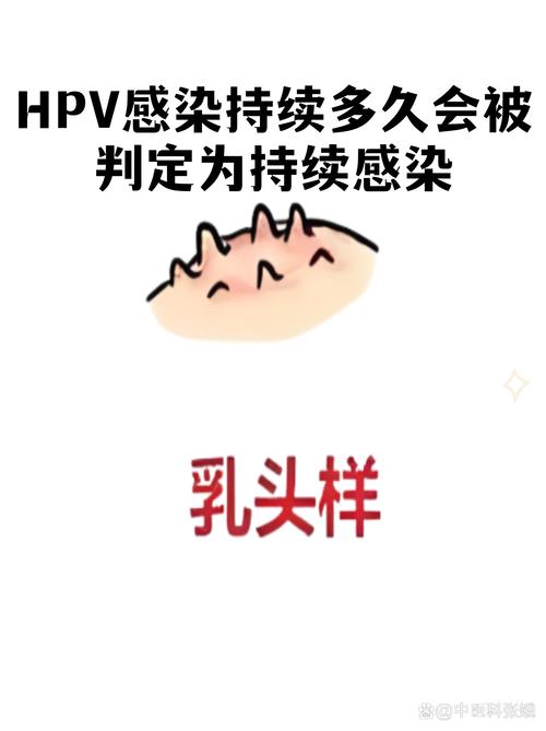 HPV持续感染多久会进展