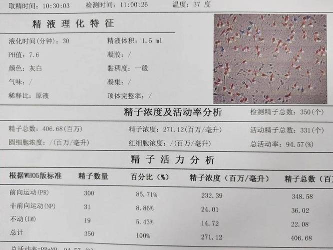 精液报告哪几项最关键