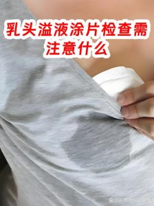 乳头溢液该做哪些影像检查？-两性知识丨两性健康--你想了解的我都知道