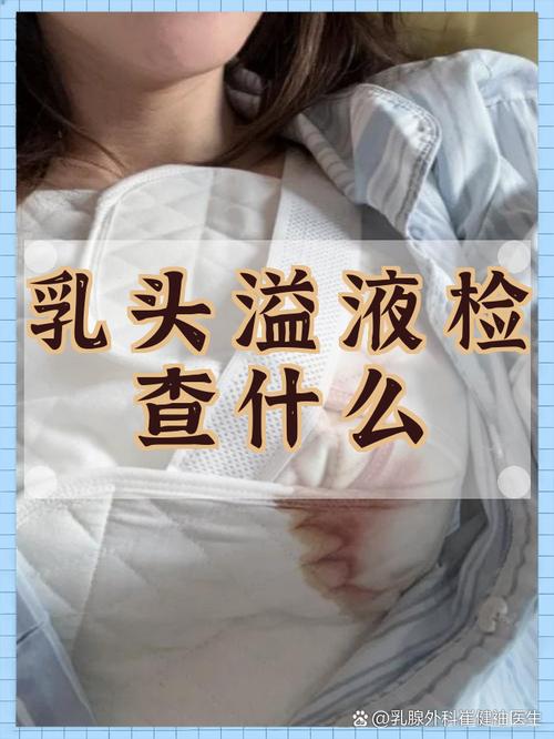 乳头溢液该做哪些影像检查