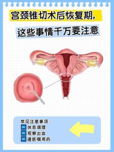 锥切术后怀孕要注意哪些事-两性知识丨两性健康--你想了解的我都知道