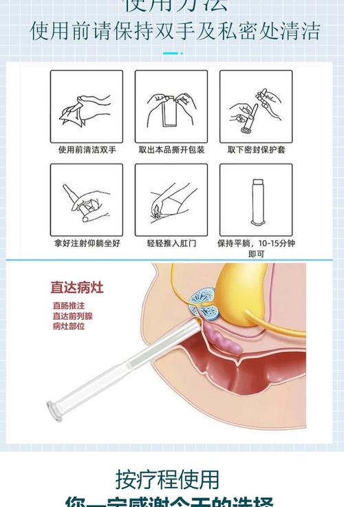 男性外用避孕凝胶进展如何