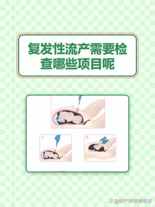 复发性流产要查男方哪些项