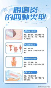 阴道炎总反复?多半是这几个习惯在添乱-两性知识丨两性健康--你想了解的我都知道